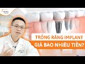 CHI PHÍ TRỒNG RĂNG IMPLANT 2021 - CÁCH GIẢM CHI PHÍ TRỒNG RĂNG IMPLANT!