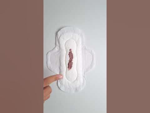 Was bedeutet brauner Ausfluss - YouTube