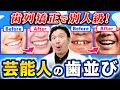 【ビフォーアフター】芸能人の歯並びを解説してみた！