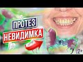 НЕВИДИМЫЙ Бюгельный Протез На Верхнюю Челюсть