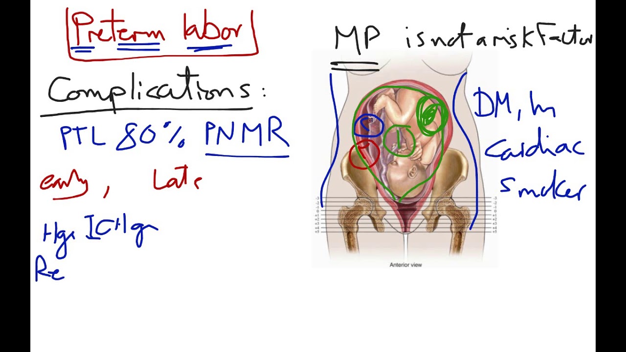 Preterm labor - YouTube