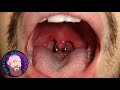 The Whole Truth - Uvula Piercing