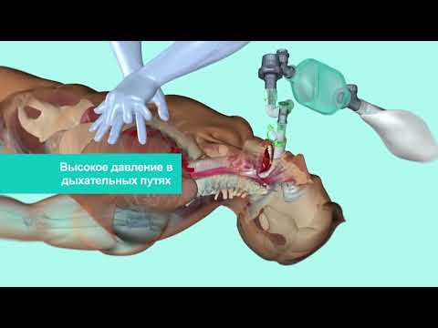 Вопрос: Как очистить место введения сердечного катетера?