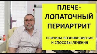 Плечелопаточный периартрит. Почему возникает и как лечить.