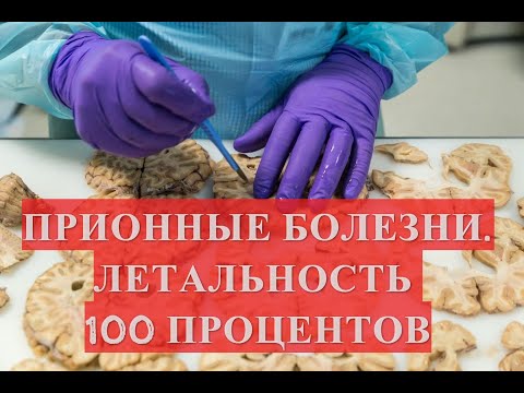 Медленные, но идеальные убийцы. Летальность 100. Прионы и прионные болезни.