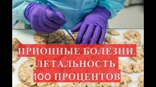 Медленные, но идеальные убийцы. Летальность 100%. Прионы и прионные болезни.