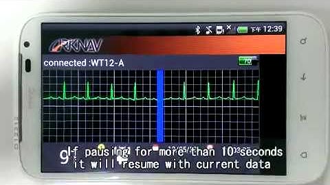 ARKNAV KARDIA ECG Monitor with Android App