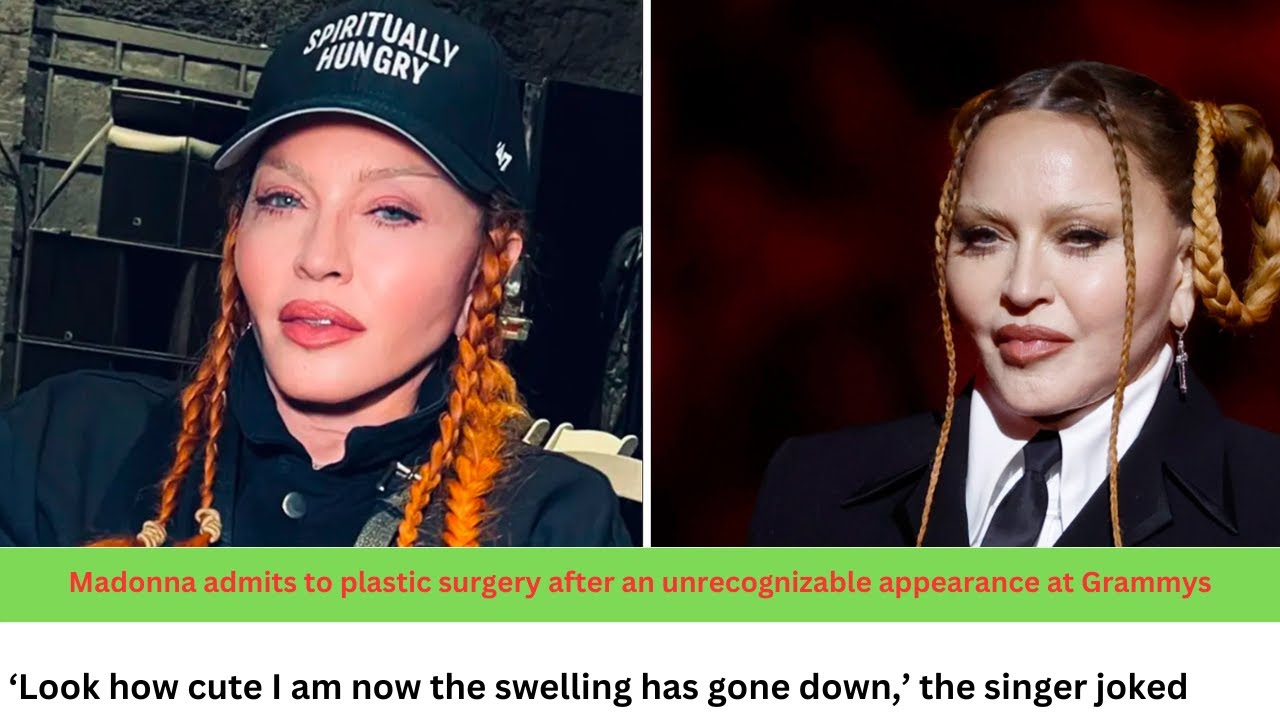 Madonna admits to plastic surgery after that unrecognisable appearance at  Grammys