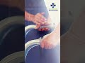 क्या Knee Replacement Surgery के बाद फिर से चल पाना मुमकिन है? | Knee Surgery | Knee Replacement