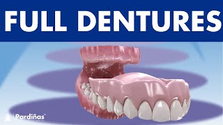 Removable FULL DENTURE  How to clean and care for complete dentures ©