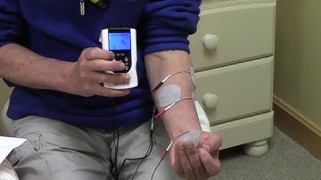 Stroke Rehabilitation: Use of electrical stimulation to help the fingers be able to open and close