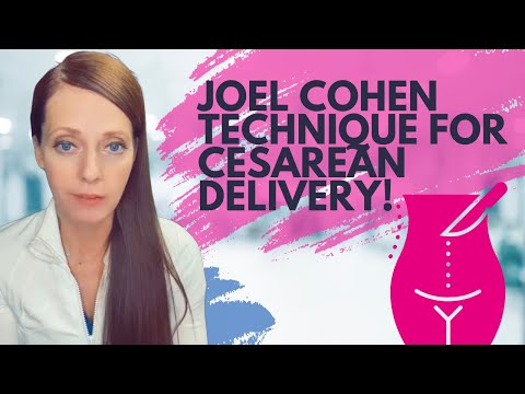 Wideo: Laparotomia Joela-Cohena: technika cięcia cesarskiego