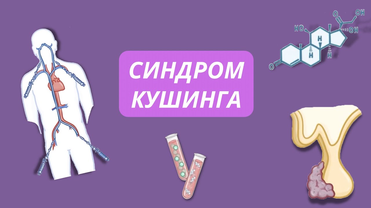 Что такое Болезнь Кушинга? | Лечение - YouTube