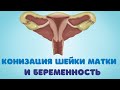 Конизация шейки матки и беременность @DrOlenaB