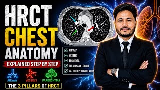 HRCT Chest Anatomy Explained Step by Step