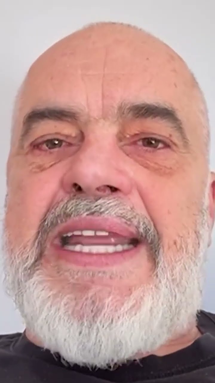 Top Channel/ “Shqipëria për të huajt dhe pak për shqiptarë”, Rama-komentuesit: Me të vërtetë e ke?