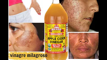 ¿Ayuda el vinagre de manzana a tensar la piel?
