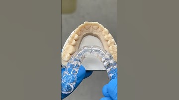 Soothing Protection Splint @EnvisiontecMain #envisiontec #dental #teeth #smile #lsk121shorts