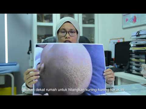 Video: Masalah Kulit Pada Bayi Pramatang - Garis Kesihatan