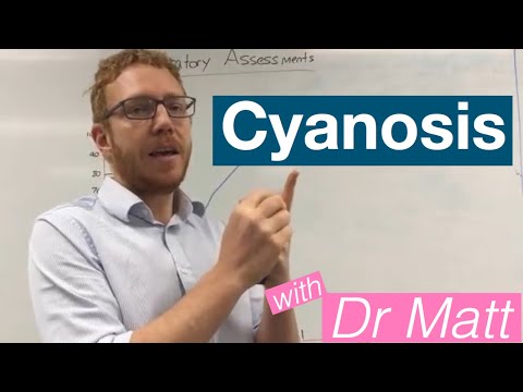 Video: Cianoză