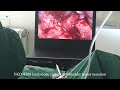 Medical Endoscope Camera for Laparoscopic Surgery - IKEDA 9100 All in One Endoscopy System
