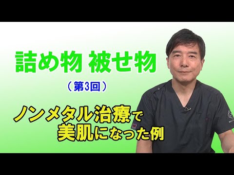 お口のノンメタル治療動画「詰め物、被せ物（第3回）～ノンメタル治療で美肌になった例～」