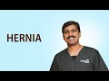 Hernia | Symptoms & Treatment | When To Seek Medical Help | Healthcare | Dr Mehta's Hospitals