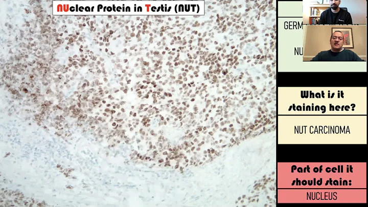 Imunohistoquímica na Patologia