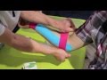 taping tapen Golferellenbogen / Epicondylitis ulnaris humeri