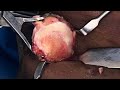 Knee cap pain treatment by BMAC