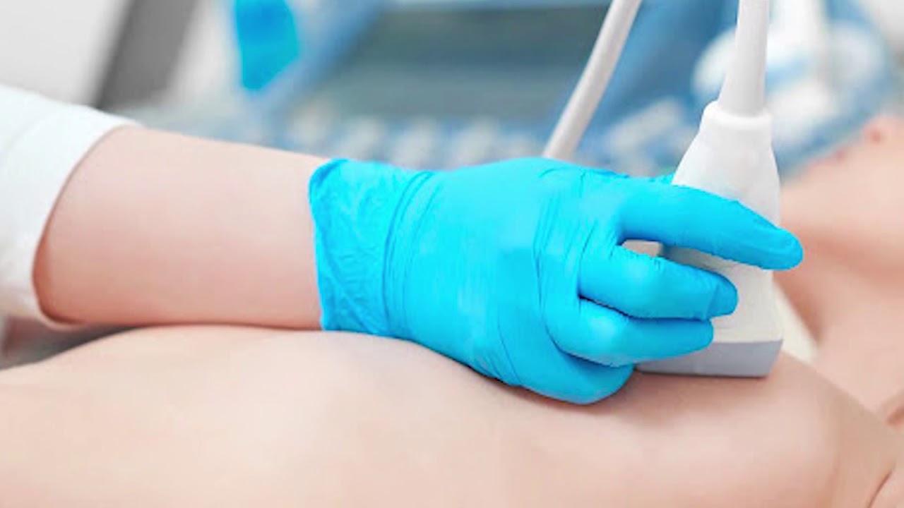 Meme Biyopsi Nasıl Yapılır?