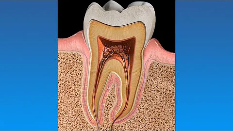 ¿Pueden los dientes dañar los nervios?