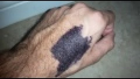 Remove Permanent Marker From Skin Using Toothpaste