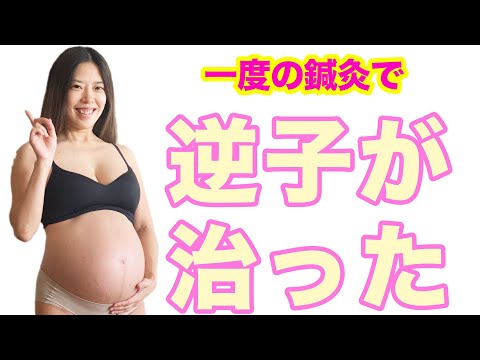 【妊娠・出産】一度で逆子がなおった！妊娠34週での鍼灸院レポ！【逆子治療】