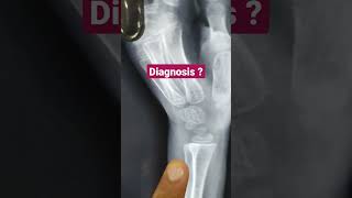 Diagnosis ? Dr Sai Chandra MBBS DNB Ortho