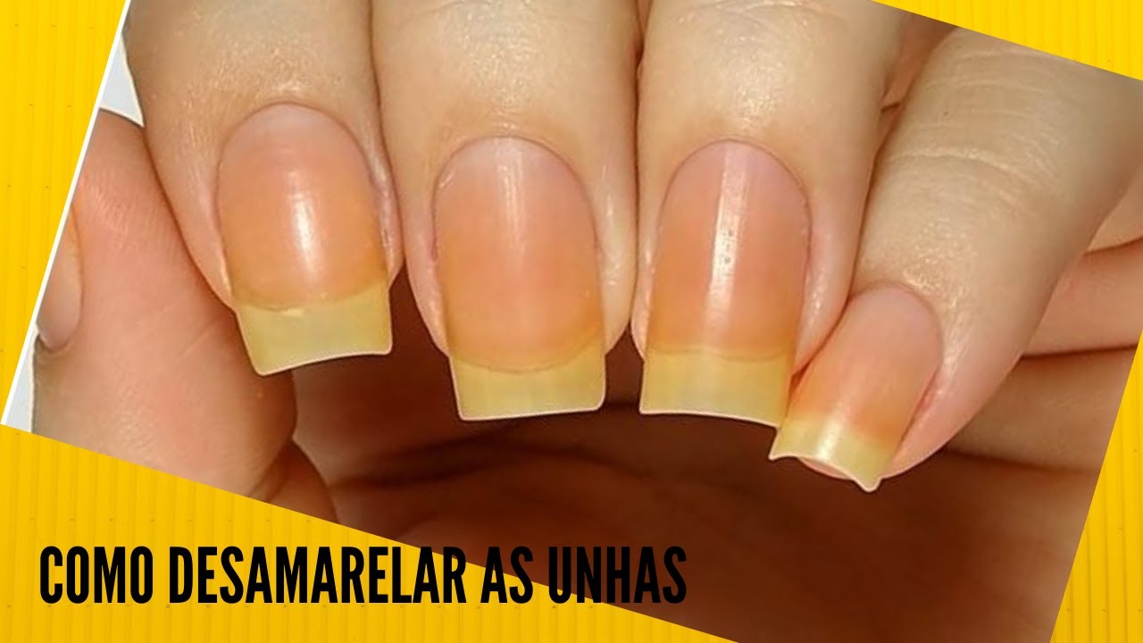 COMO TIRAR O AMARELADO DAS UNHAS - YouTube