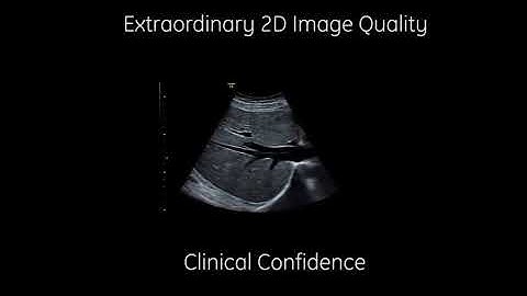 VOLUSON P8 GE | SIYS MEDICAL