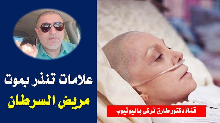 8 علامات تنذر بأن مريض السرطان موشك على الموت  | علامات تنذر بموت مريض السرطان