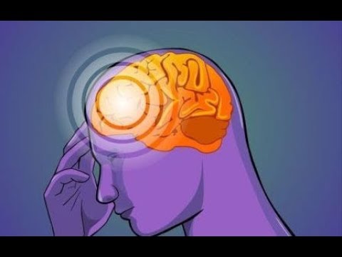 Vídeo: Encefalopatía Hipertensiva Del Cerebro: Que Es, Tratamiento