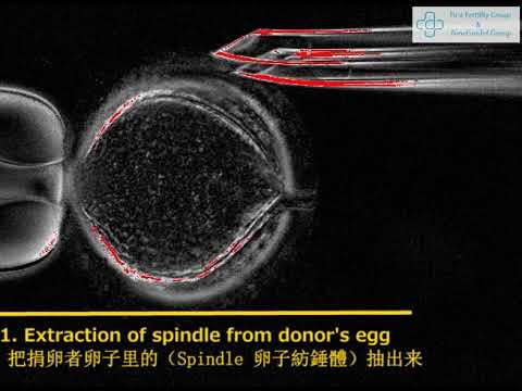 线粒体置换疗法