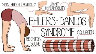 Ehlers Danlos Syndrome Explained Clearly by Rhesus Medicine 15,330 views 8 months ago 7 minutes