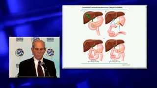 Dr. Bennett Roth on Digestive and Nutritional Issues Following Surgery for Pancreatic Cancer