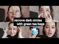 remove under eye dark circles remedy | 3 different remedy wrinkles puffy eyes with home made cream