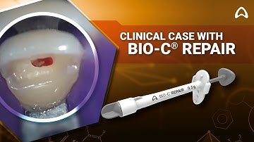 BIO-C Repair application in pulpotomy