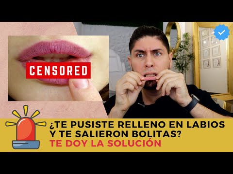 Video: ¿Puedes masajear el relleno migrado?