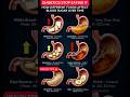 Food As Medicine🍌How Foods Affect Blood Sugar Level Overtime🥣☘️Blood Sugar Control Tips💁#viralshorts