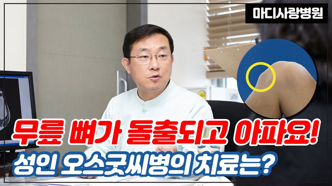 무릎 뼈가 돌출되고 아파요! 성인 오스굿씨병의 치료는?