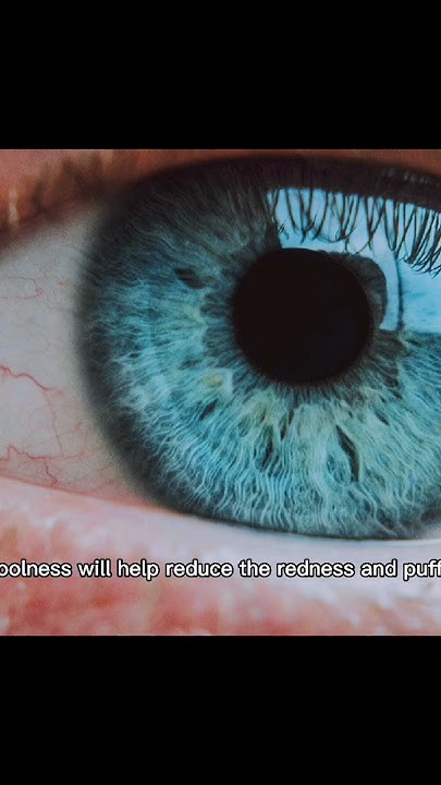 how-to-relieve-red-eyes-without-eye-drops-shorts-youtube