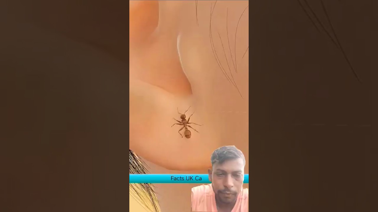#factsकान में घुसा चींटी क्याहोगा #shorts #shortvideo #viralshorts #youtubeshorts #trending