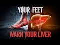 Your Cracked Heels and Spider Veins Are Liver Damage Warnings